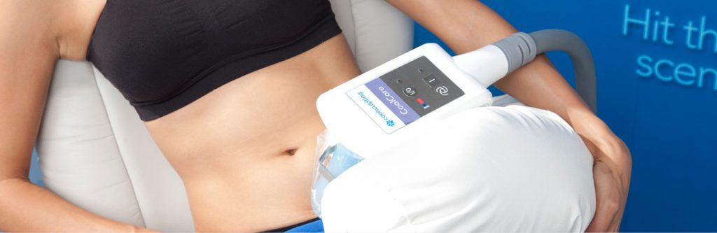coolsculpting on a female tummy