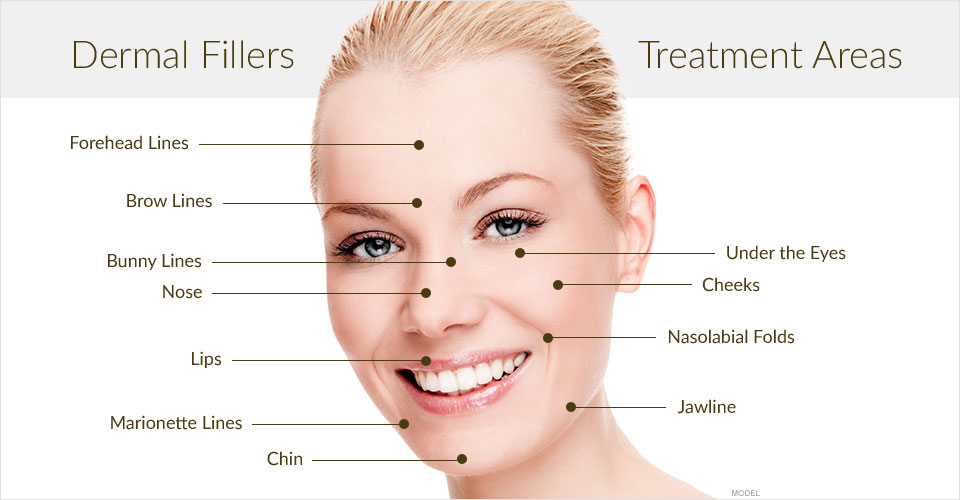 dermal filler injection face area