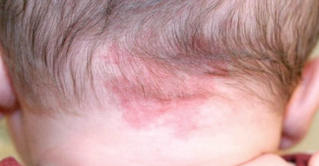 Macular stains