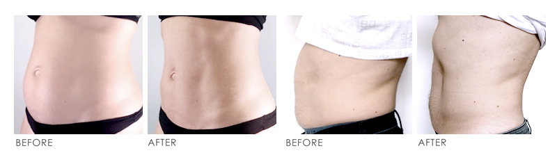 FMS before_after