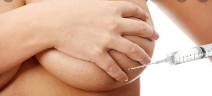 treatment breast filler