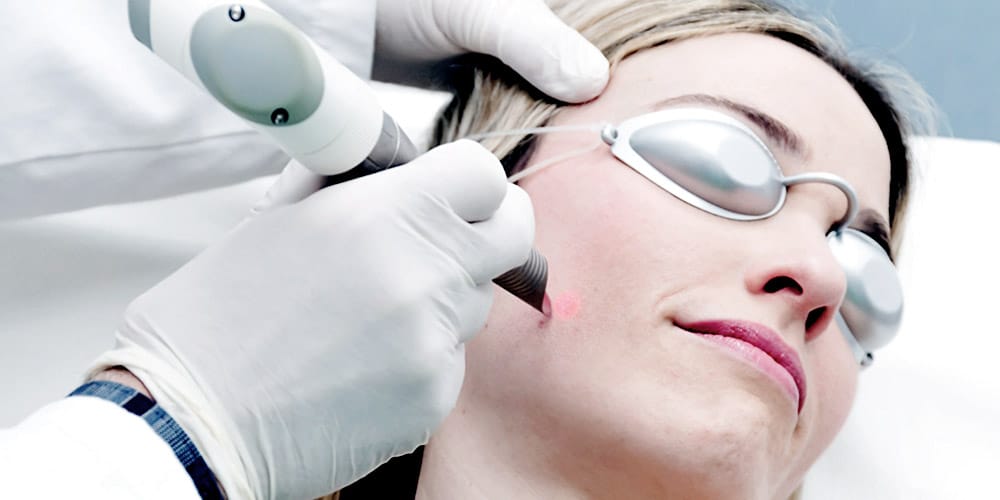 4d face lift laser