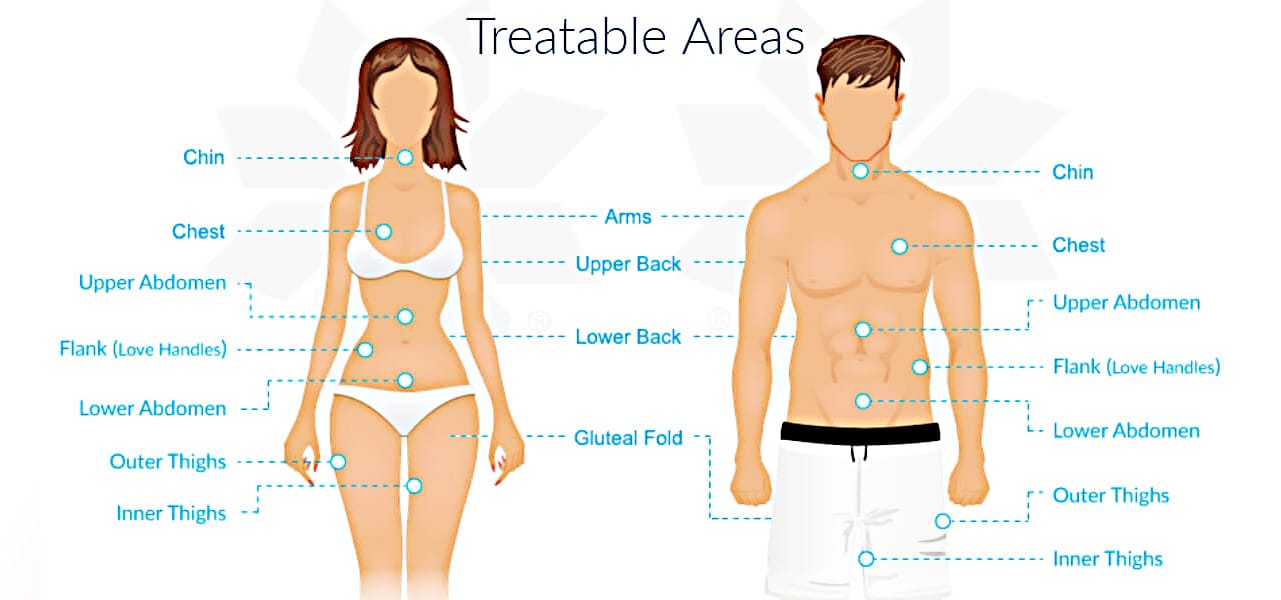CoolSculpting