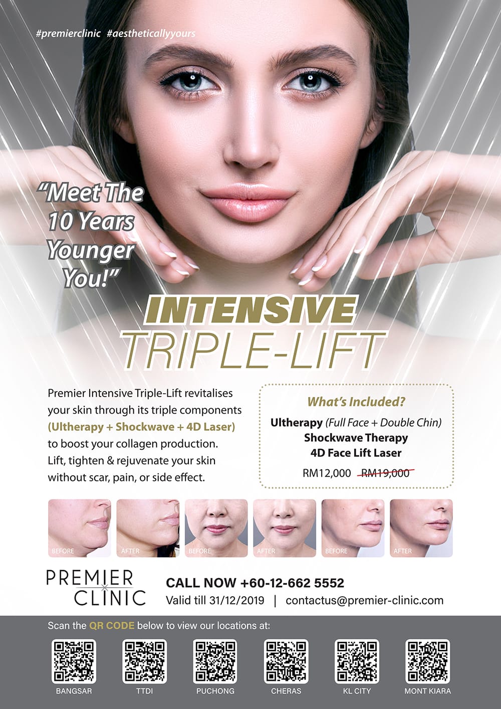 Intensive Triple-Lift