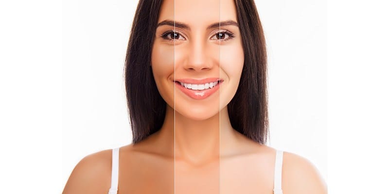 SKIN WHITENING