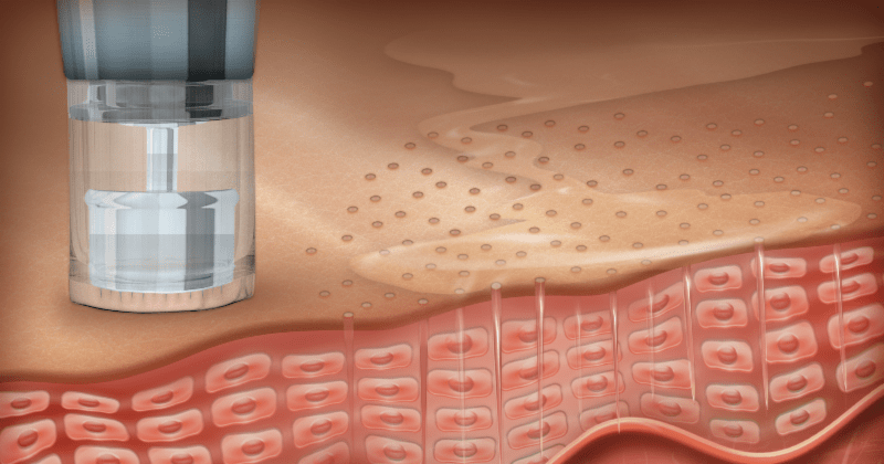 ADVANCED DERMAPEN