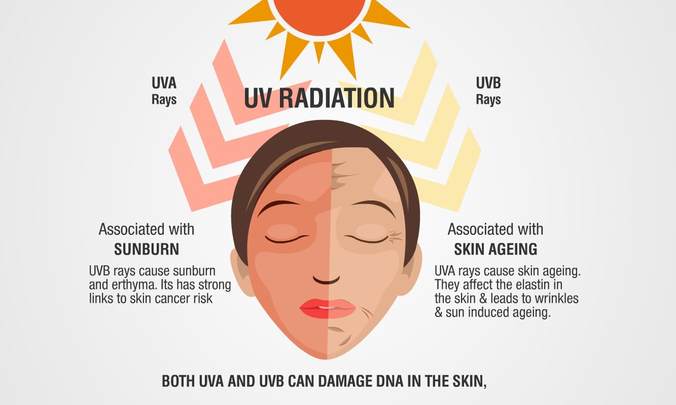4 caused of pigmentation