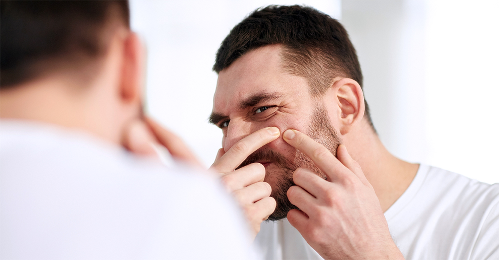 What Causes Acne Scars?