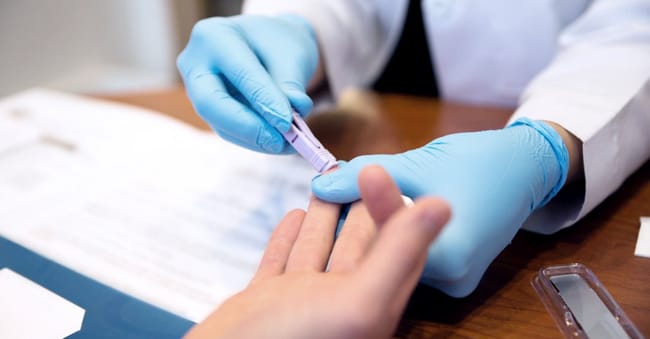 Acute HIV infection