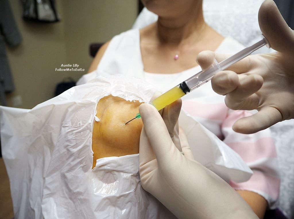 prp injected into knee