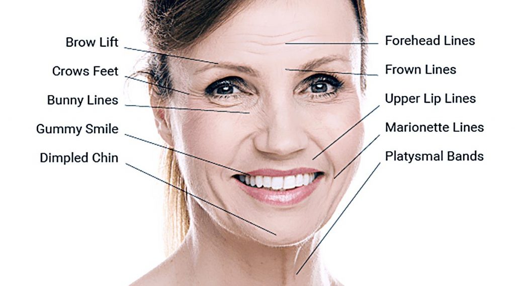 BOTULINUM TOXIN