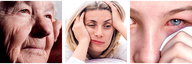 Causes Of Eye Bags