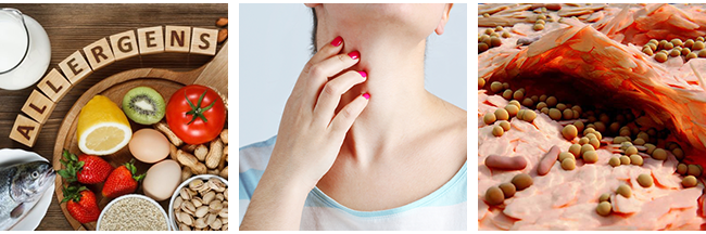 Causes of Eczema