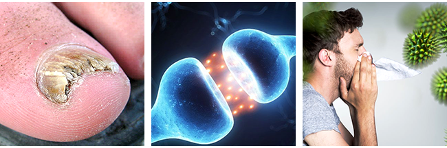 Causes of Fungal Infections