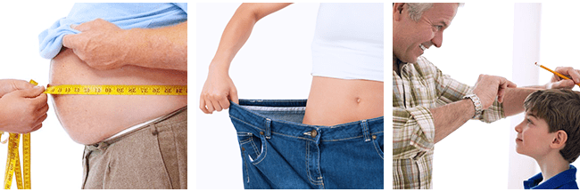 Causes of Stretch Marks