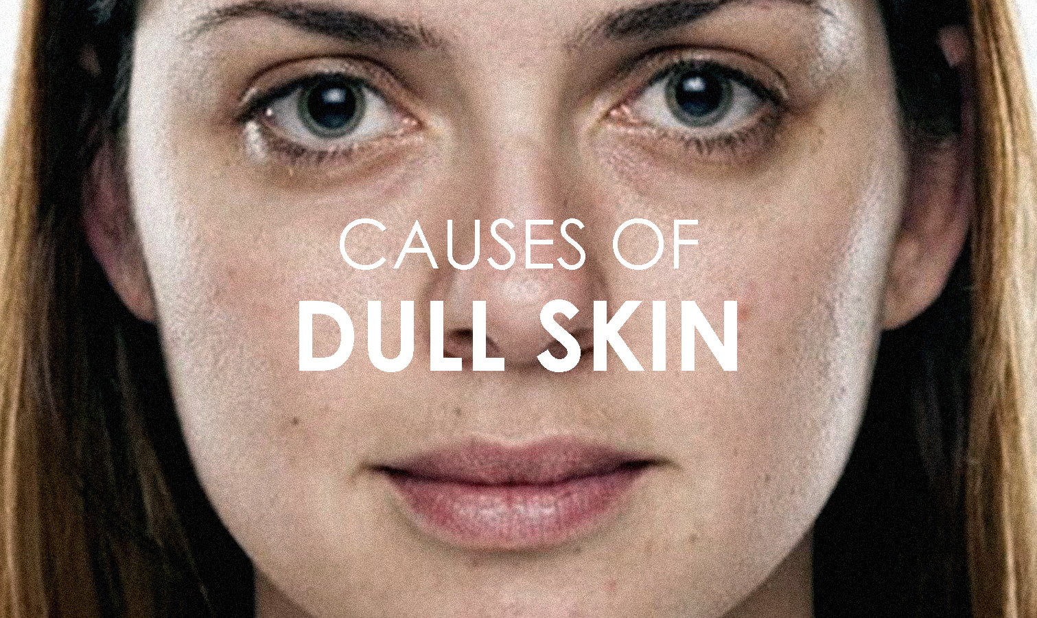 DULL SKIN