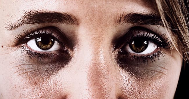 Dark Circles