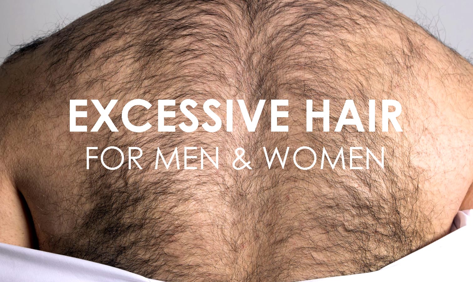 EXCESSIVE HAIR Cover