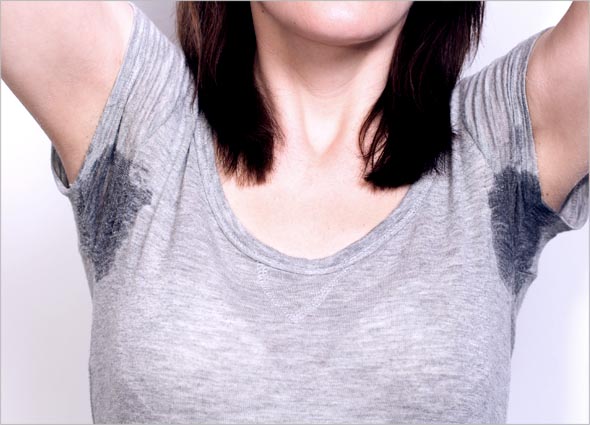 Excessive Sweating