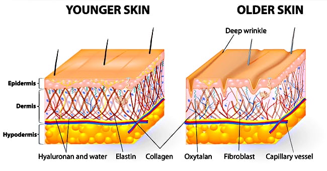 How Does Wrinkly Skin Happen