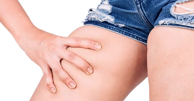 How does Genital Pigmentation Happen