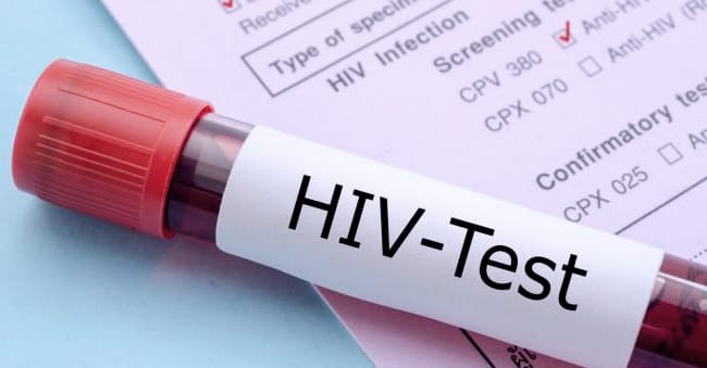 How to Prevent HIV