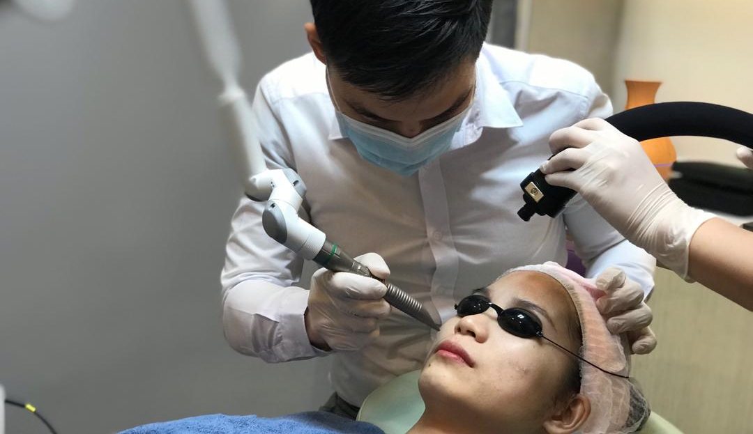 Fotona Laser for face