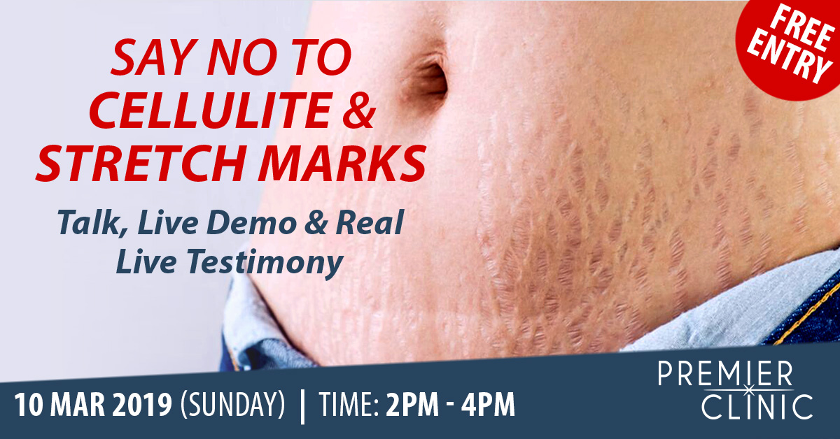SAY NO TO STRETCH MARKS & CELLULITES!