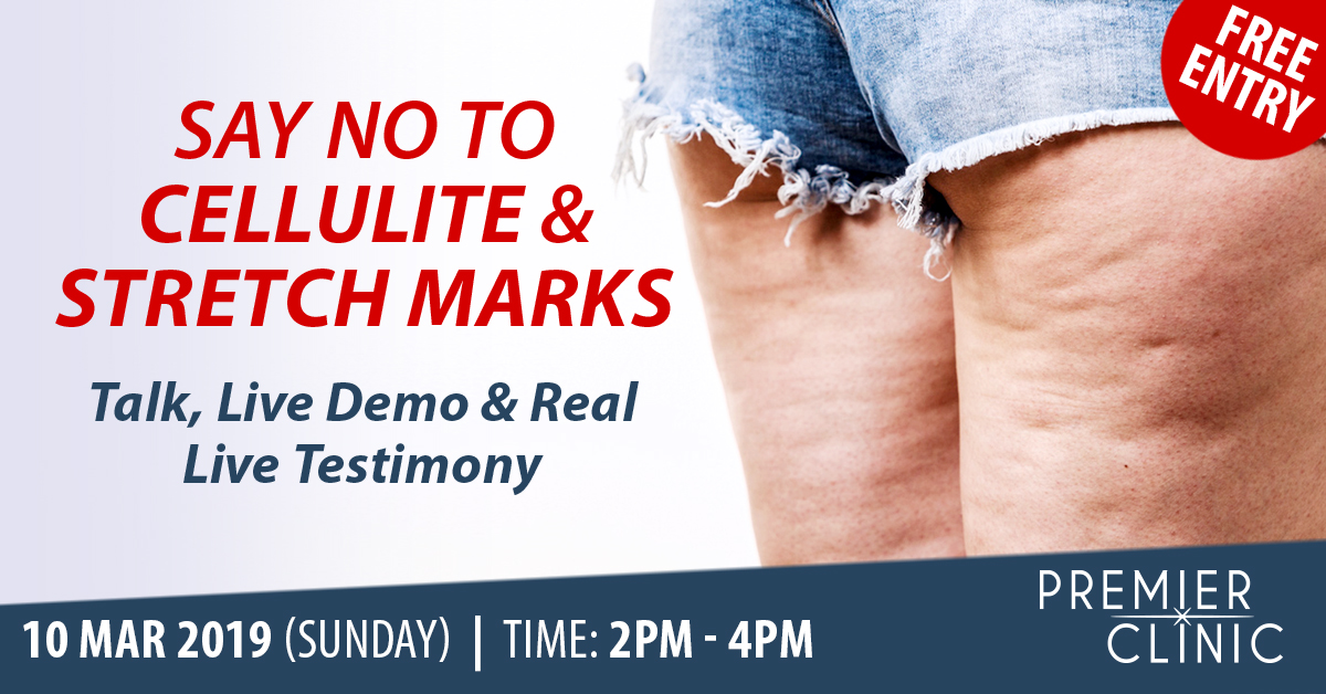 SAY NO TO STRETCH MARKS & CELLULITES!