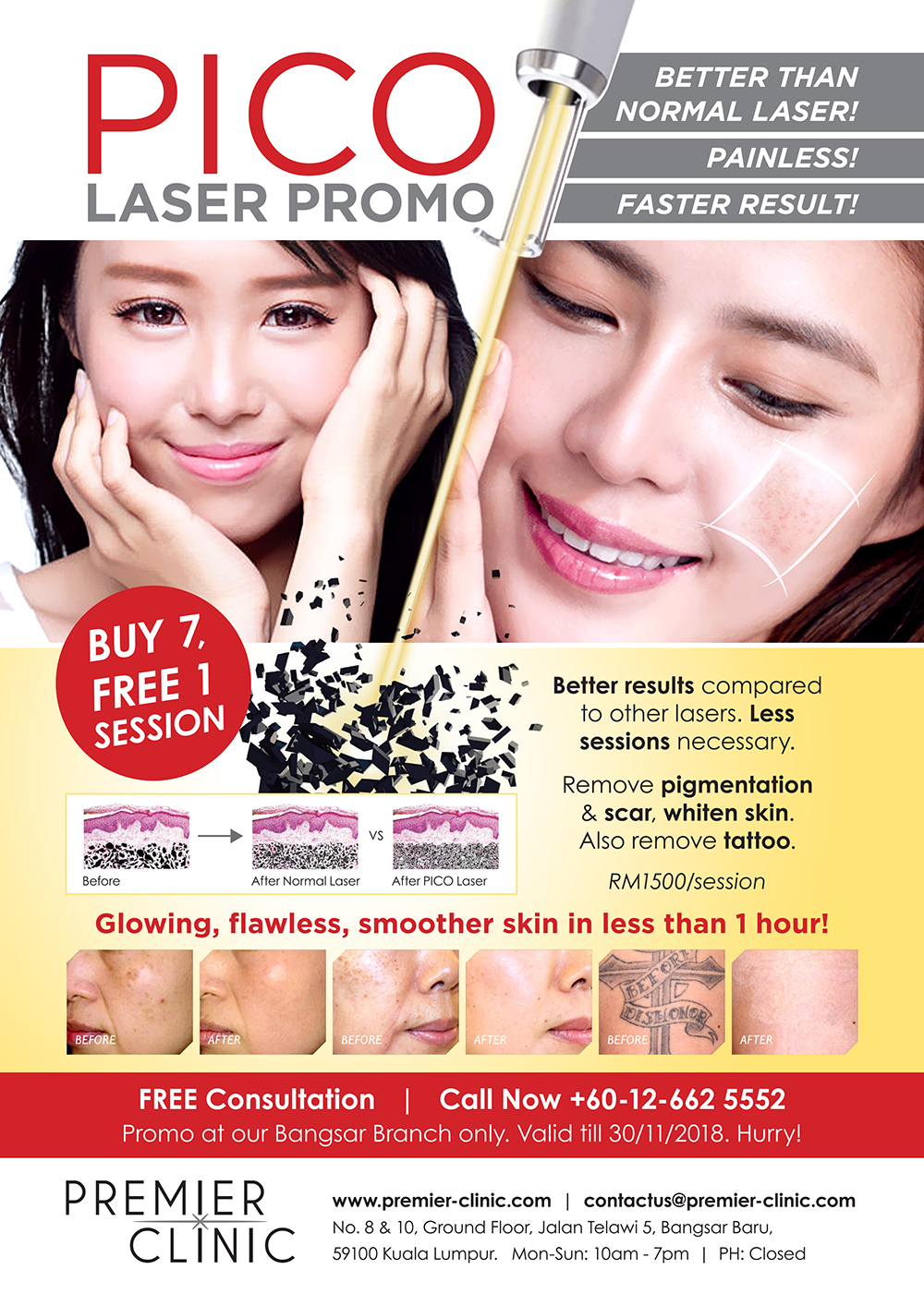 PICO Laser Promo PREMIER CLINIC