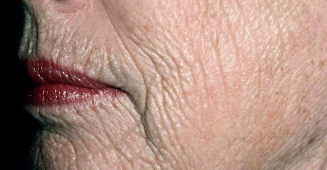 Permanent Elastic Creases