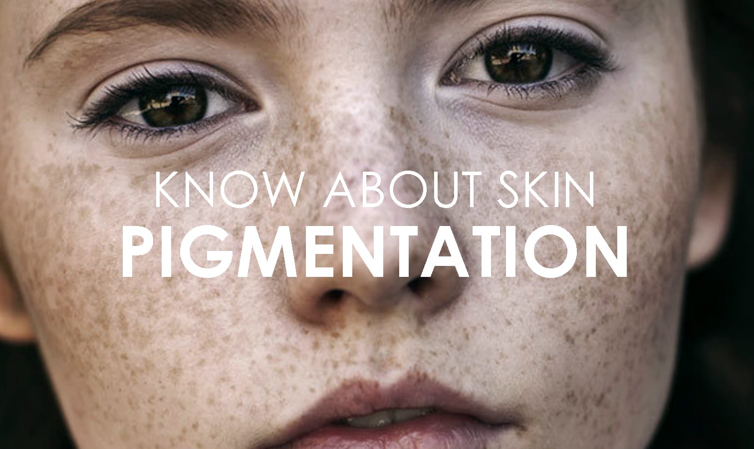 SKIN PIGMENTATION Cover
