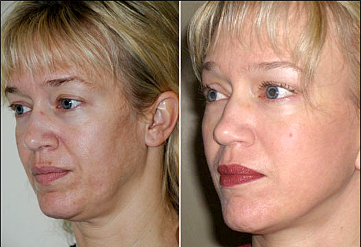aesthetic clinic Malaysia