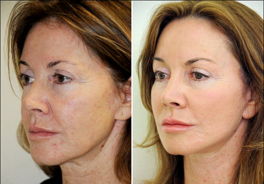 aesthetic clinic Malaysia
