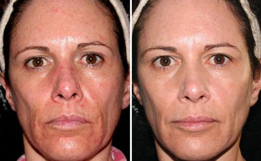 aesthetic clinic Malaysia