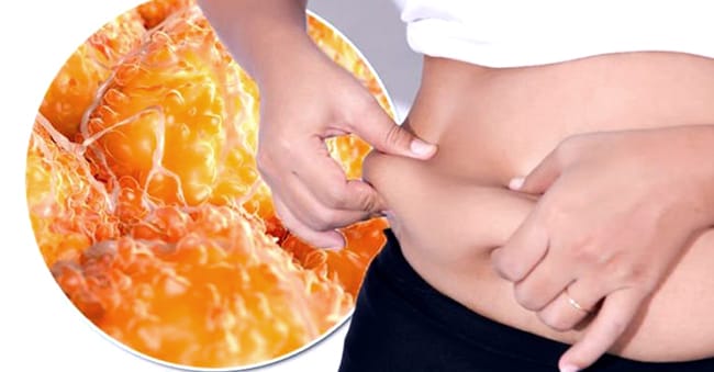 Subcutaneous Fat