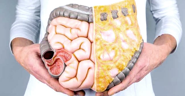 Visceral Fat