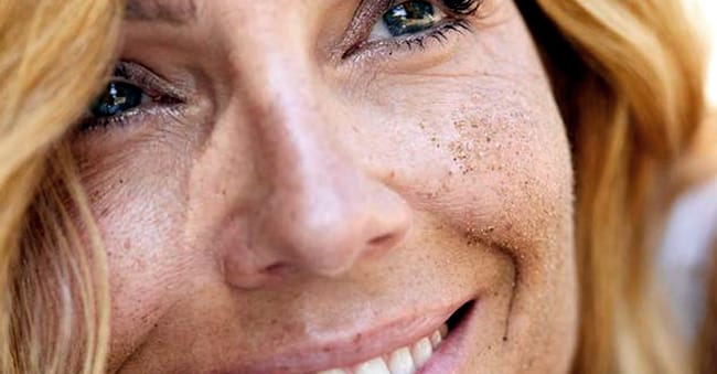 What Does Uneven Skin Tone Mean
