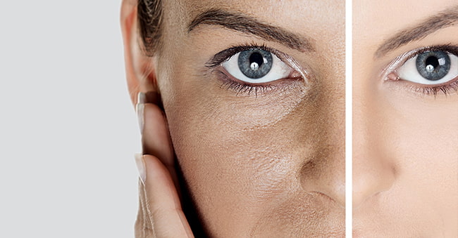 What Is Dull Skin