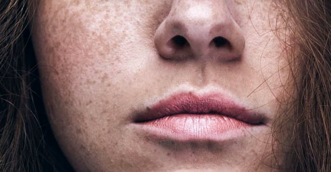 What Is Pigmentation