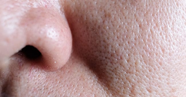 What are Facial Pores