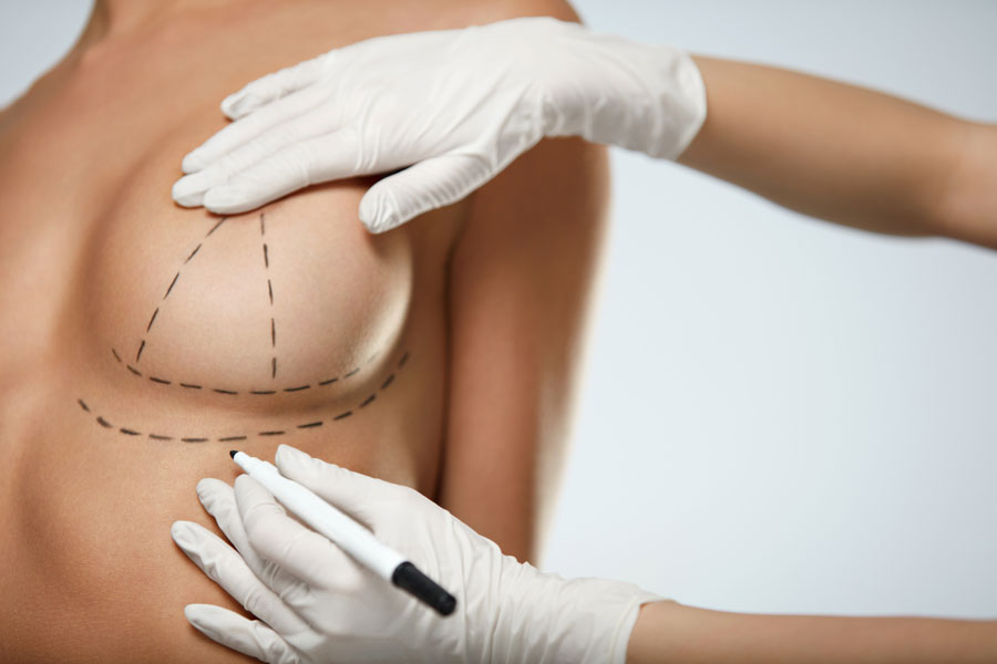 breast-lift-botox