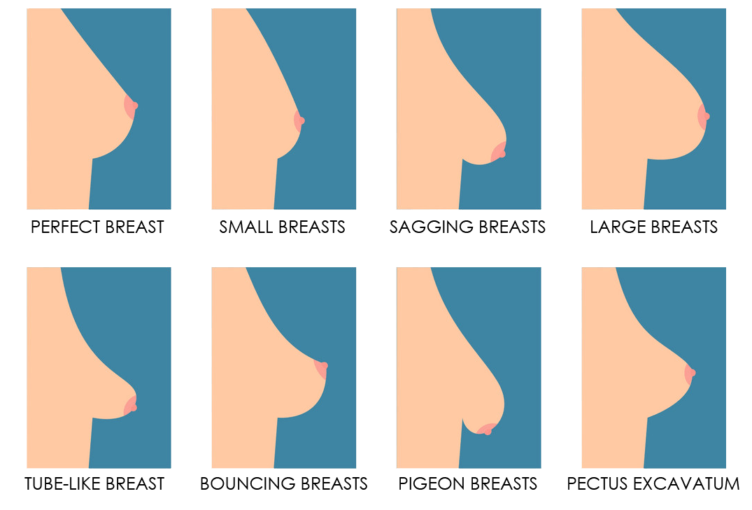 breast shape