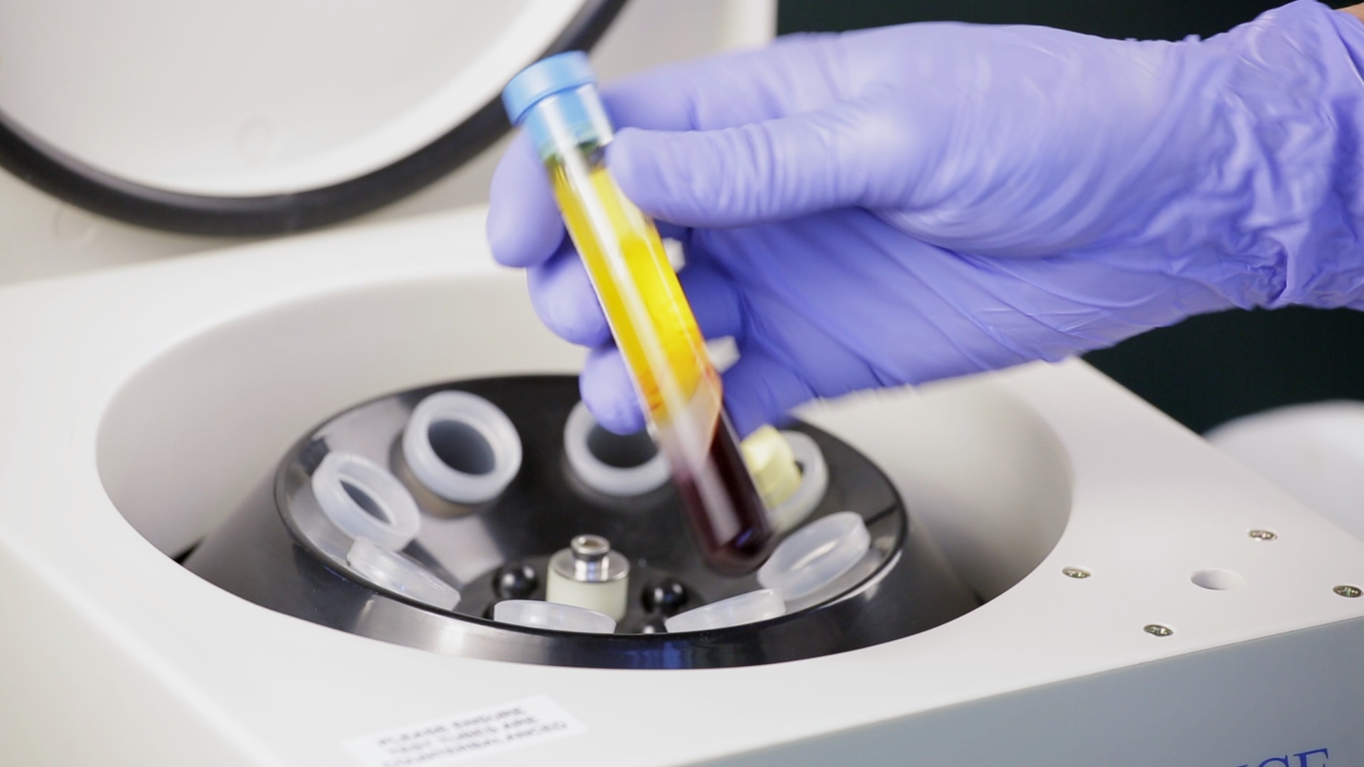 Cellular Matrix PRP - Treatment for Knee Injury