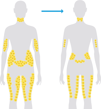 Who is a Good Candidate for CLATUU Treatment?