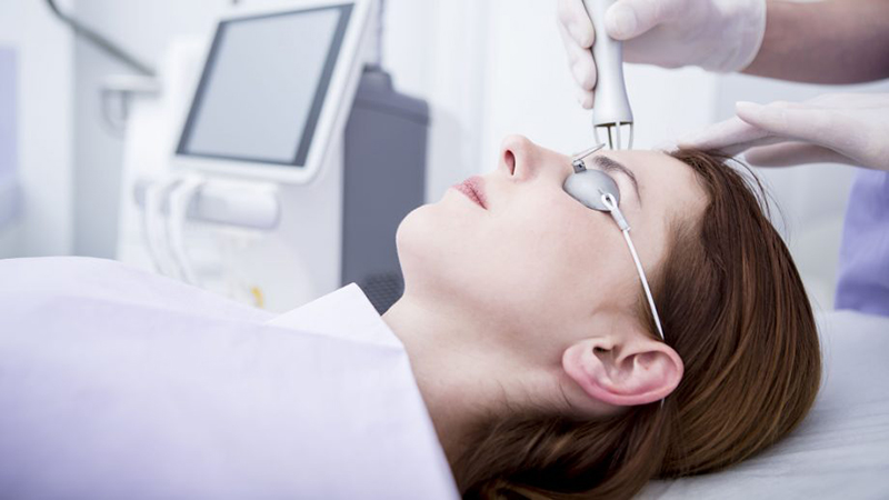 Get Laser Treatment For Acne Scars