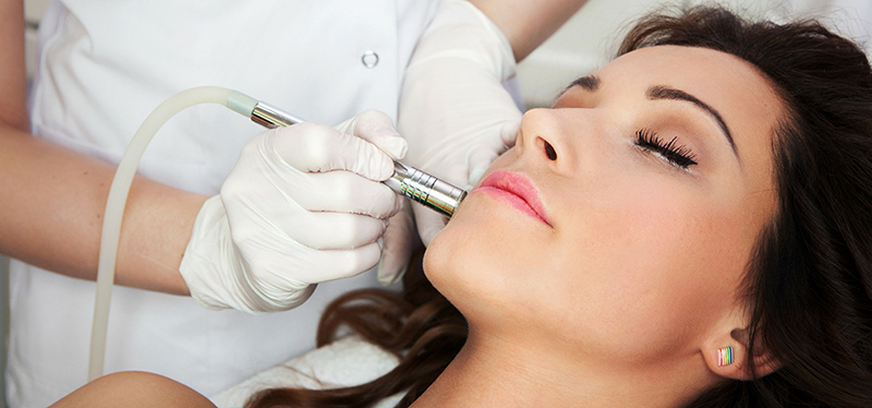 microdermabrasion