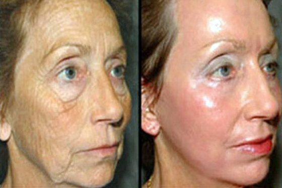 aesthetic clinic Malaysia