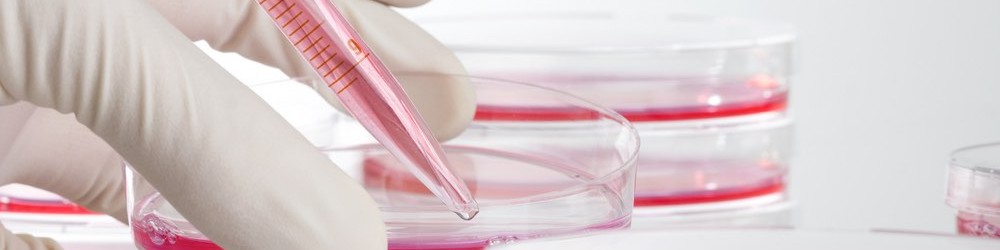 Stem Cell Therapy