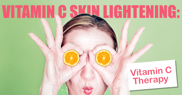 vitamin C therapy